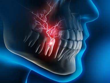 Implantat Versorgungen der Zähne müssen geplant werden zuerst Diagnose.